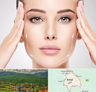 لیفت صورت در آمل