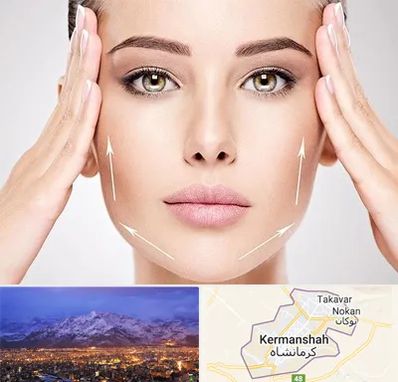 لیفت صورت در کرمانشاه