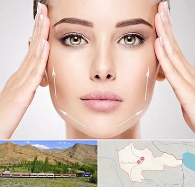 لیفت صورت در خاش