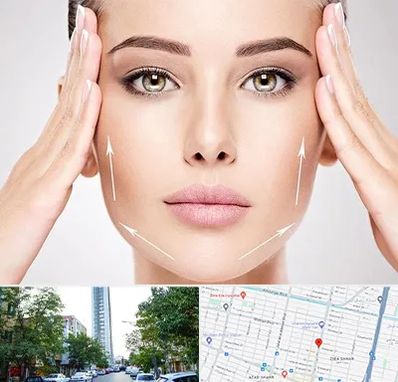 لیفت صورت در امامت مشهد