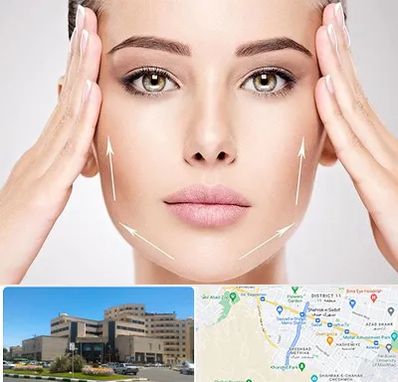 لیفت صورت در صیاد شیرازی مشهد