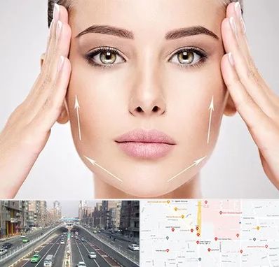 لیفت صورت در توحید