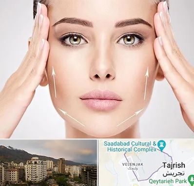 لیفت صورت در زعفرانیه 