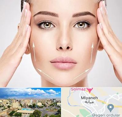 لیفت صورت در میانه