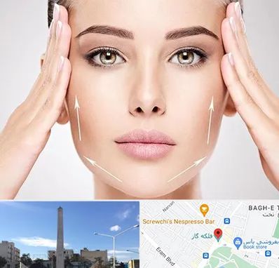 لیفت صورت در فلکه گاز شیراز