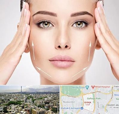 لیفت صورت در گیشا 