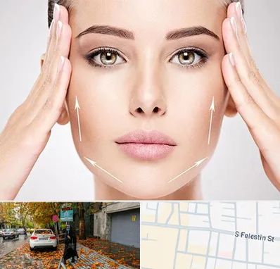 لیفت صورت در خیابان فلسطین