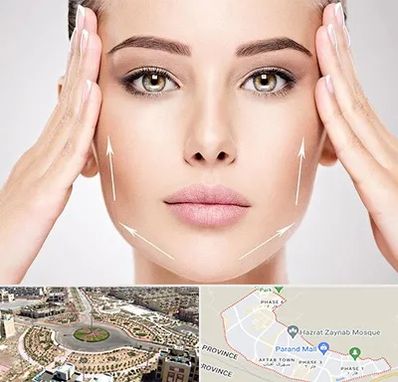 لیفت صورت در پرند