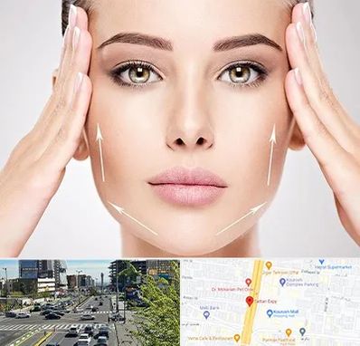 لیفت صورت در ستاری