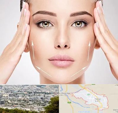 لیفت صورت در یاسوج