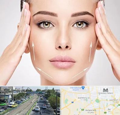 لیفت صورت در جنوب تهران 