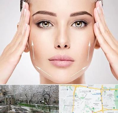 لیفت صورت در باغ فیض