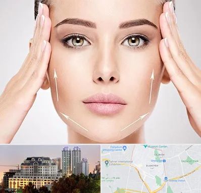 لیفت صورت در فرشته 