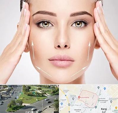 لیفت صورت در شاهین ویلا کرج