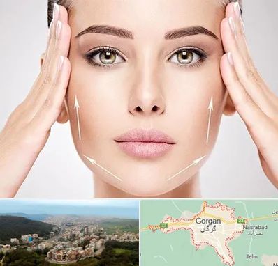لیفت صورت در گرگان