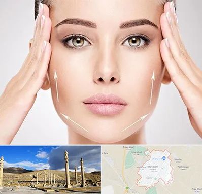 لیفت صورت در مرودشت