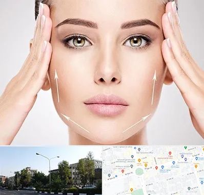 لیفت صورت در میدان کاج