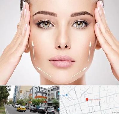 لیفت صورت در هفده شهریور تبریز