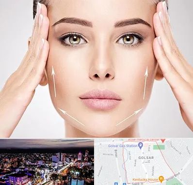 لیفت صورت در گلسار رشت 