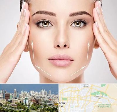 لیفت صورت در شرق تهران 