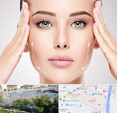 لیفت صورت در گلستان اهواز