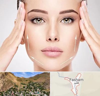 لیفت صورت در فشم