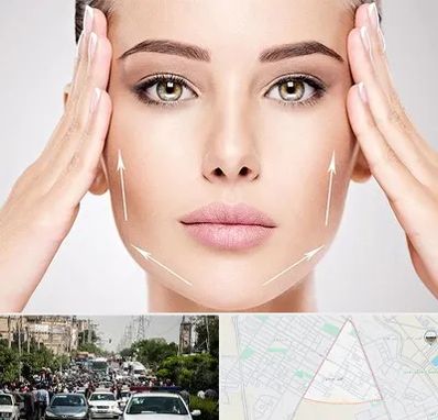 لیفت صورت در سیدی مشهد