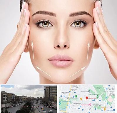 لیفت صورت در بلوار فردوسی مشهد