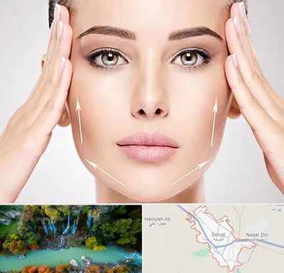 لیفت صورت در دورود