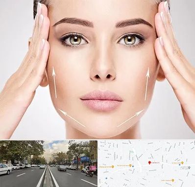 لیفت صورت در دولت