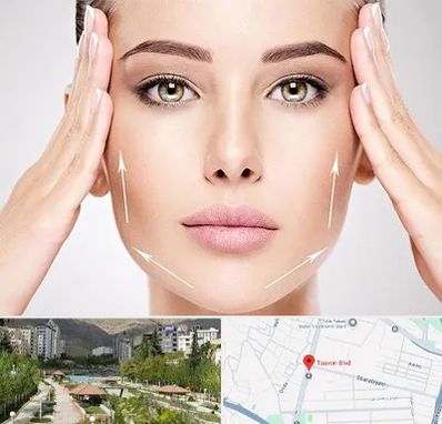 لیفت صورت در بلوار تعاون