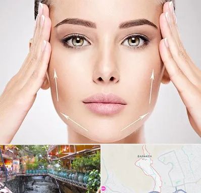 لیفت صورت در درکه