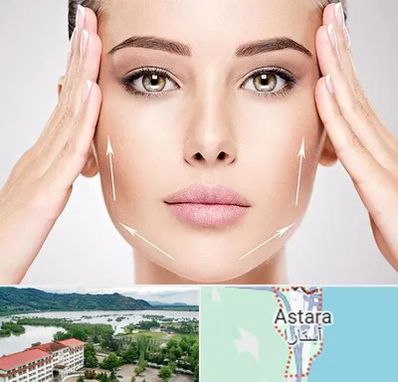 لیفت صورت در آستارا