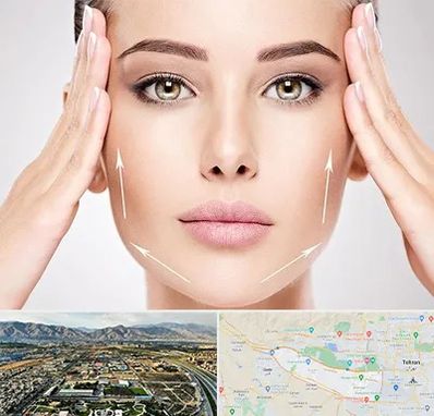 لیفت صورت در منطقه 21 تهران