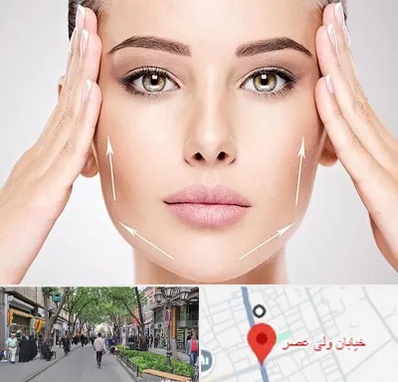 لیفت صورت در ولیعصر شهریار