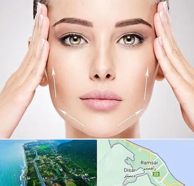 لیفت صورت در رامسر