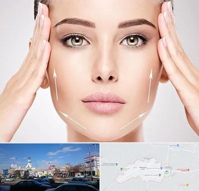 لیفت صورت در ماهدشت کرج