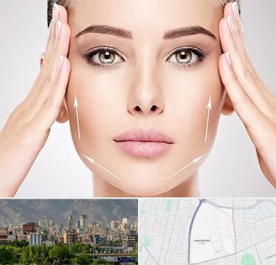 لیفت صورت در جمشیدیه