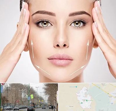 لیفت صورت در نظرآباد کرج