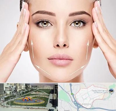 لیفت صورت در مرزداران تبریز