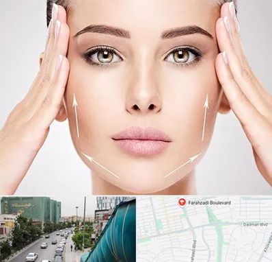 لیفت صورت در بلوار فرحزادی