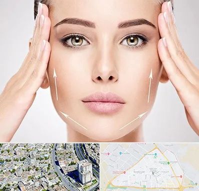 لیفت صورت در قاسم آباد مشهد