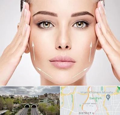 لیفت صورت در یوسف آباد 