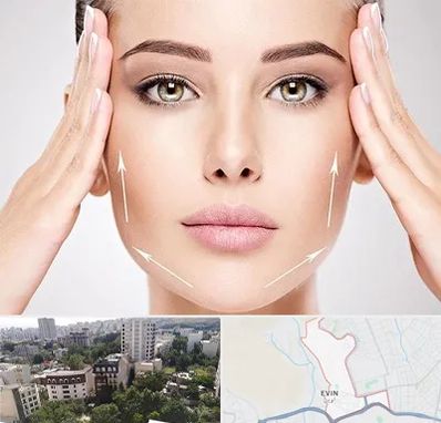 لیفت صورت در اوین