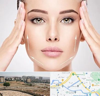 لیفت صورت در کوی وحدت شیراز