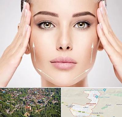 لیفت صورت در دماوند