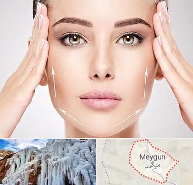 لیفت صورت در میگون