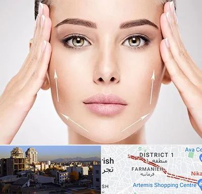 لیفت صورت در فرمانیه 