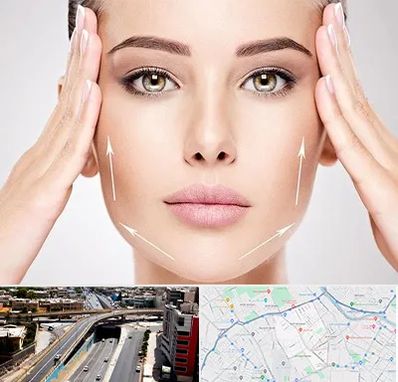 لیفت صورت در ستارخان شیراز