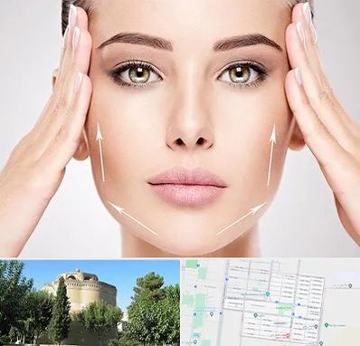 لیفت صورت در مرداویج اصفهان